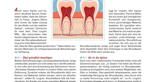 Wurzelkanalbehandlung Wurzelkanalbehandlung