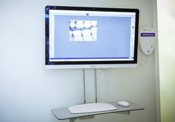 Digitales Röntgen